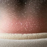 패딩목덜미 때제거방법