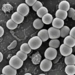 스트렙토카르푸스 삭소롬